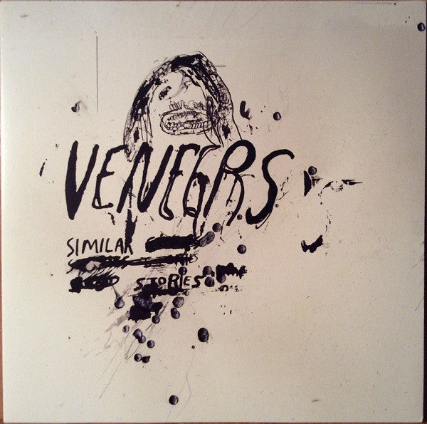 Veneers - Similar Stories