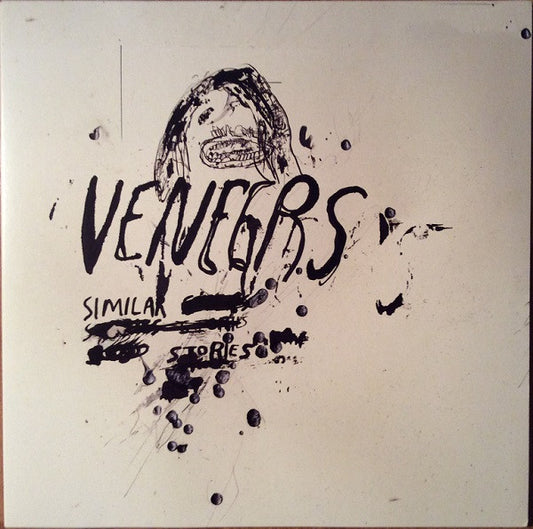 Veneers - Similar Stories